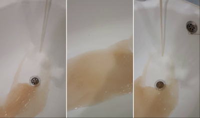 Жители Осиново жалуются на вонючую воду: после душа зуд кожи и выпадают волосы