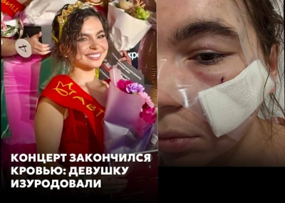 Бокалом в лицо: в Казани победительнице конкурса красоты изуродовали лицо в клубе