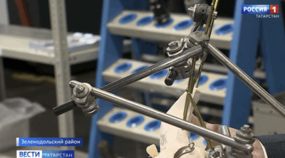 В Татарстане разработали винты для восстановления деформаций позвоночника